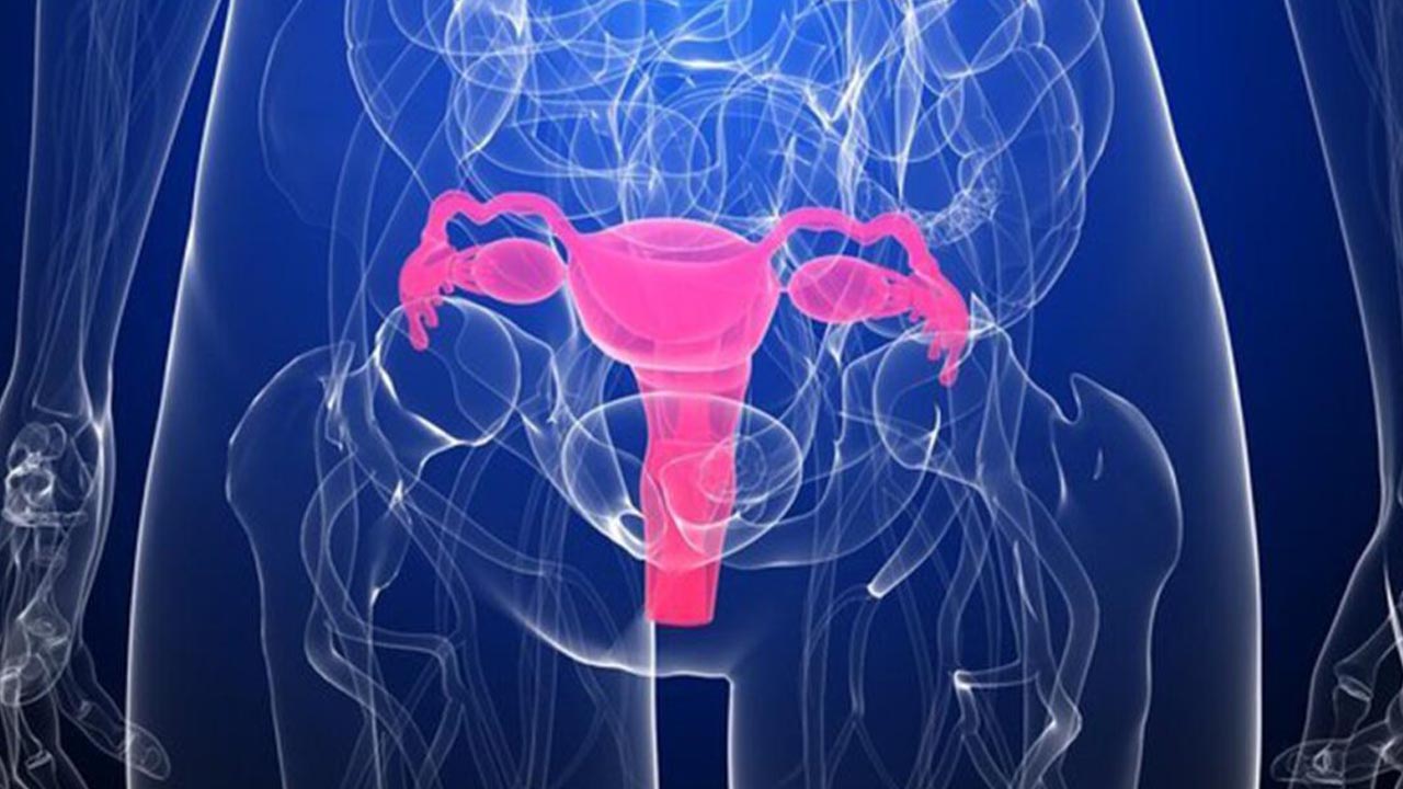 uterine fibroids