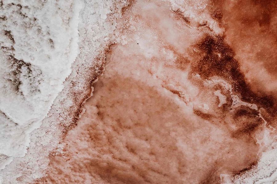 vaginal discharge symptoms