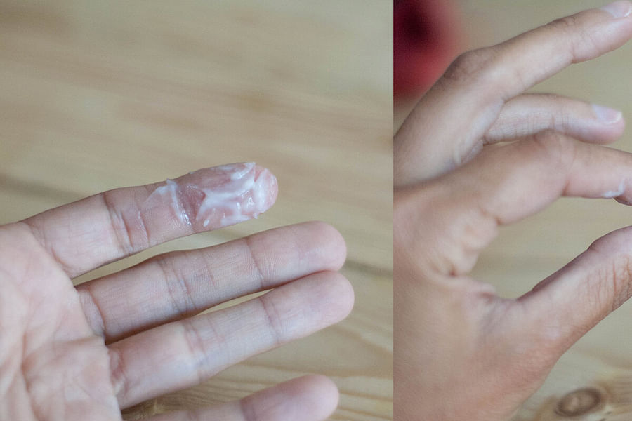 clear watery discharge follicular phase